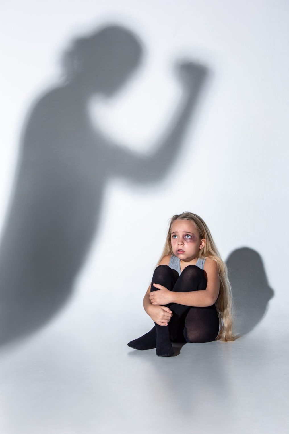 За избиение 5-летней девочки в Костроме поплатятся отчим и мать