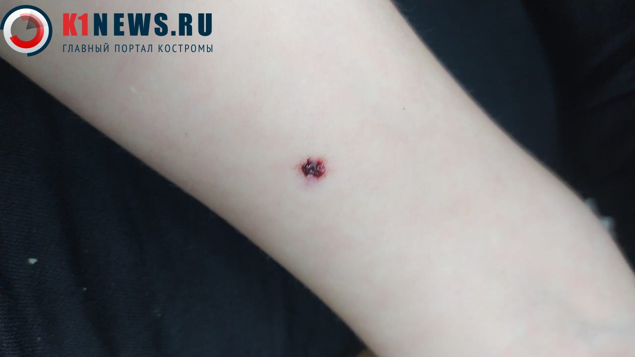 Костромских школьников массово стошнило из-за прививки Манту