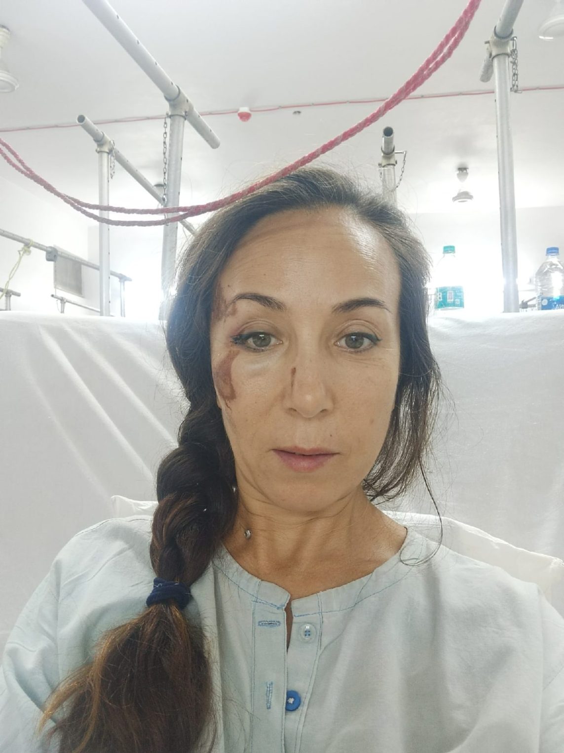 Костромичка попала в жуткую аварию на отдыхе в Индии