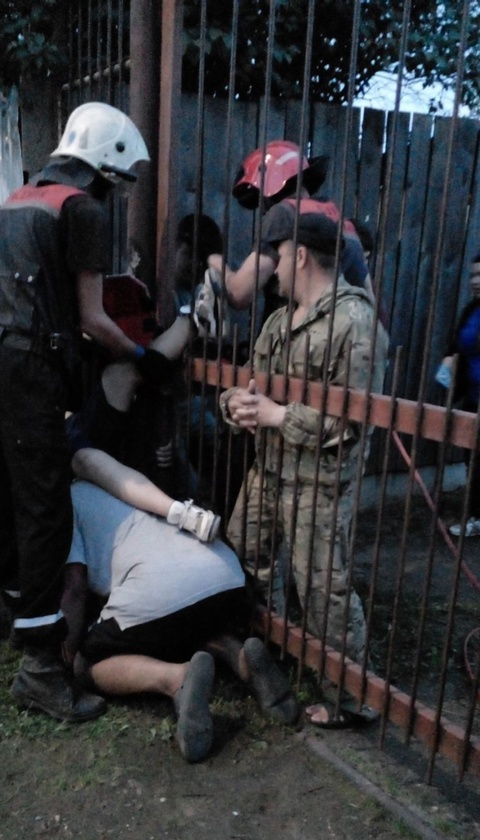 Жуть: ребенок проткнул ногу и повис на штыре забора в Костроме