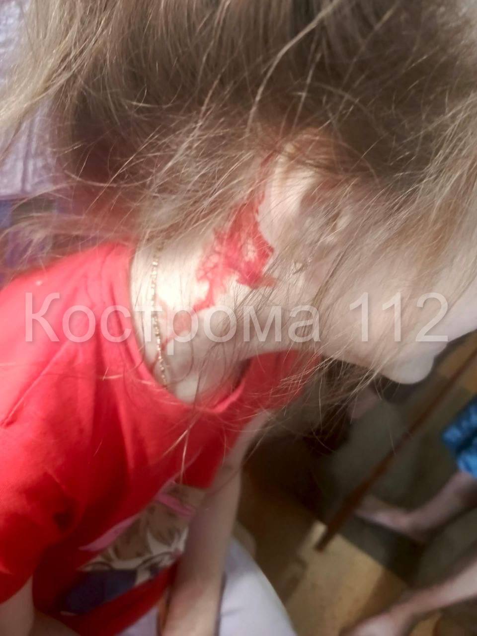 В Костроме разыскивают самокатчика, который сбил ребенка и уехал