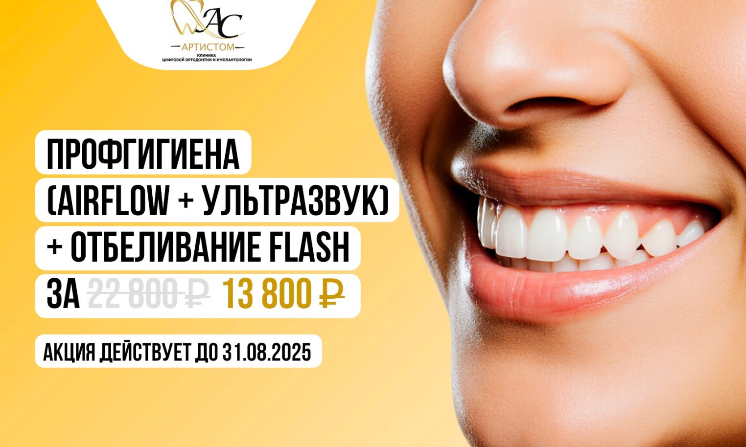 Вкусный букет летних акций подготовили в клинике «Артистом»