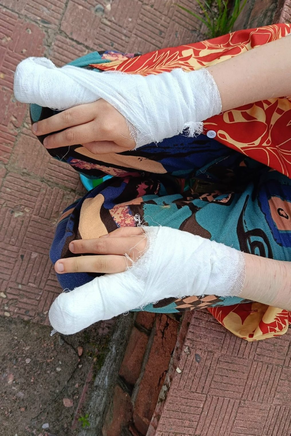 В костромском райцентре девочка сломала обе руки на неисправных качелях
