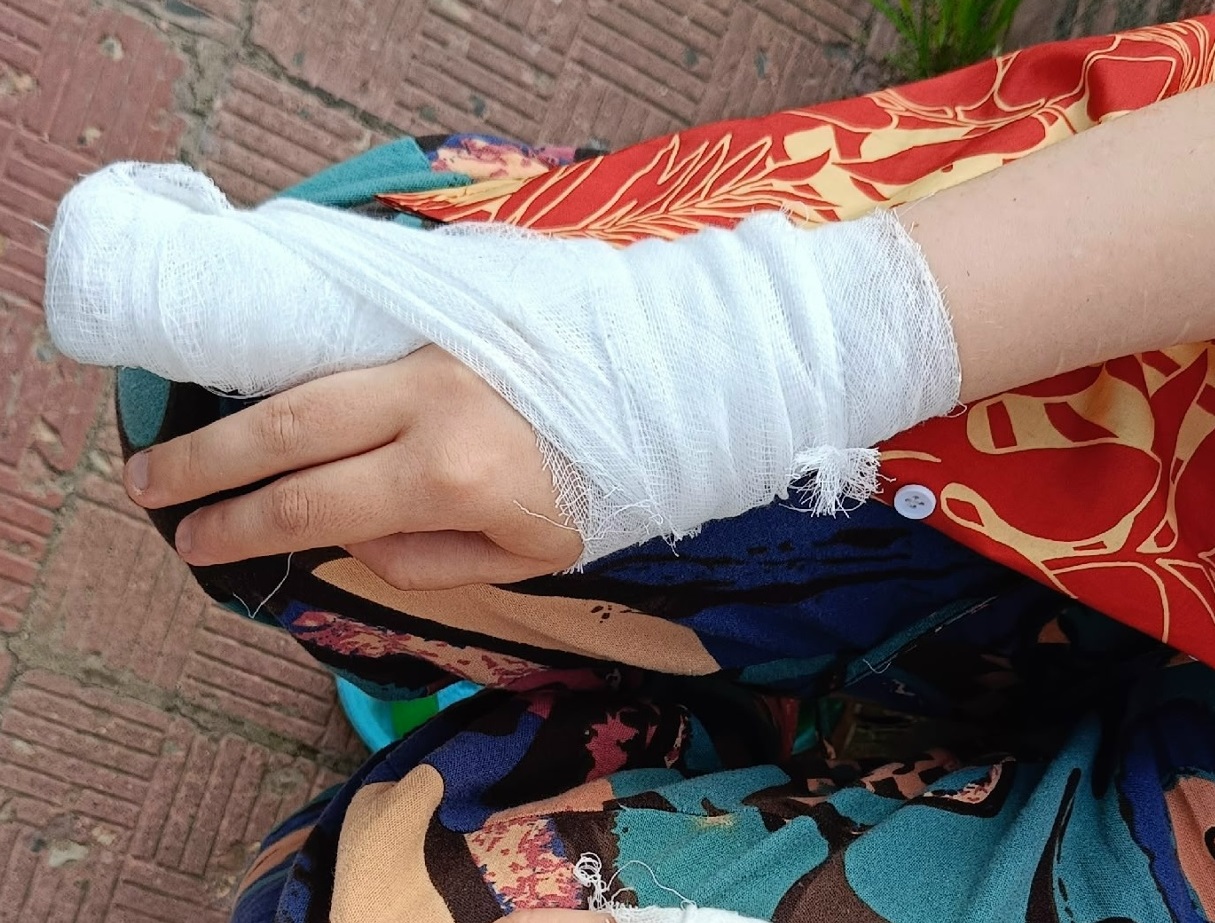 Травмой девочки на качелях в костромском райцентре заинтересовались следователи